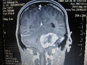 Ryan's brain in 2010